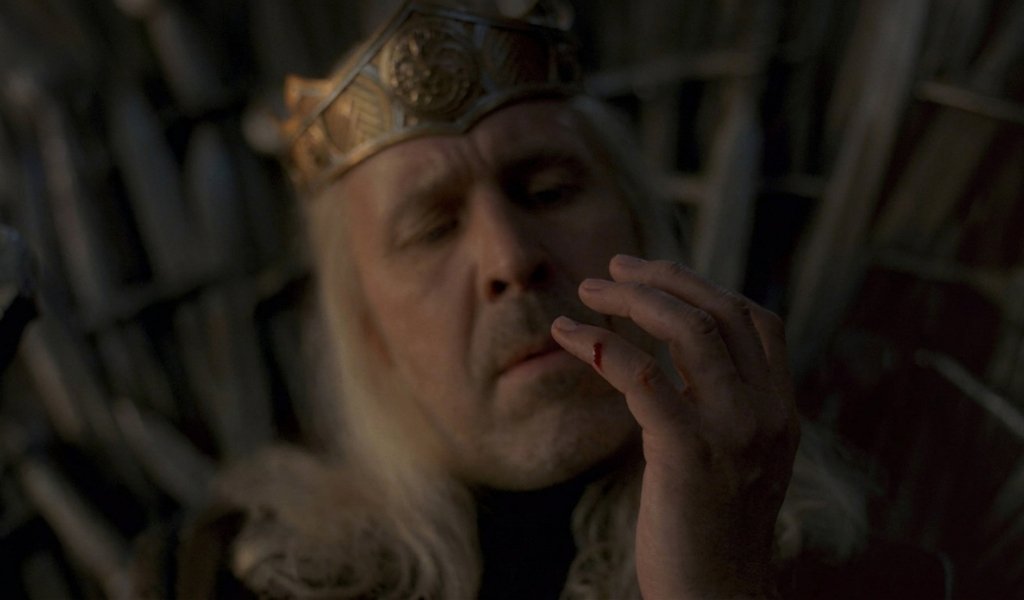 King Viserys I suffering from infected wounds caused by the Iron Throne as doom foreshadowing